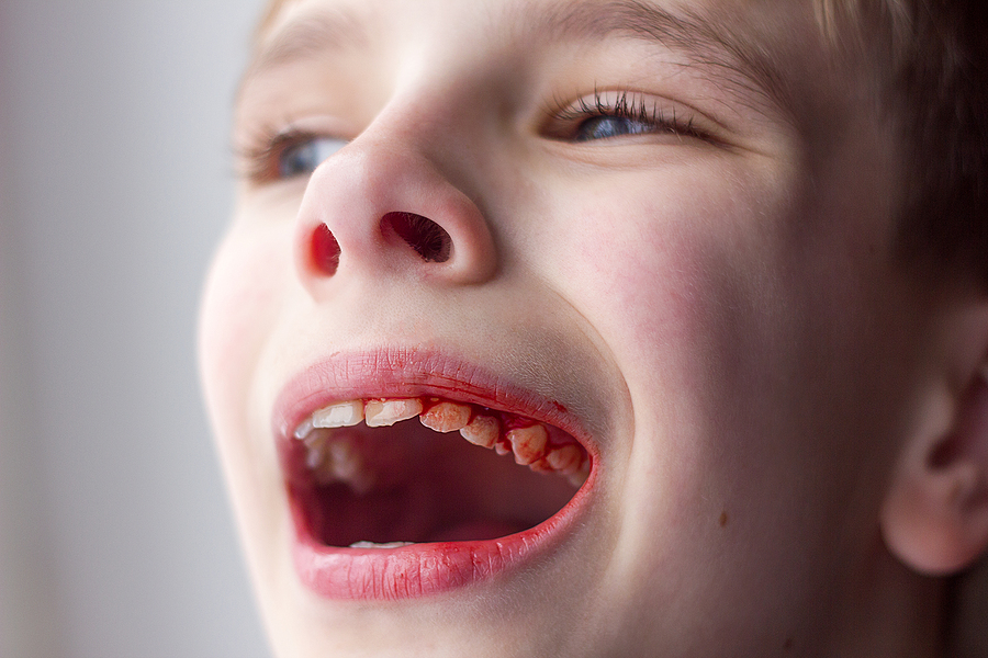 Bad Habits That Can Damage Your Child’s Oral Health