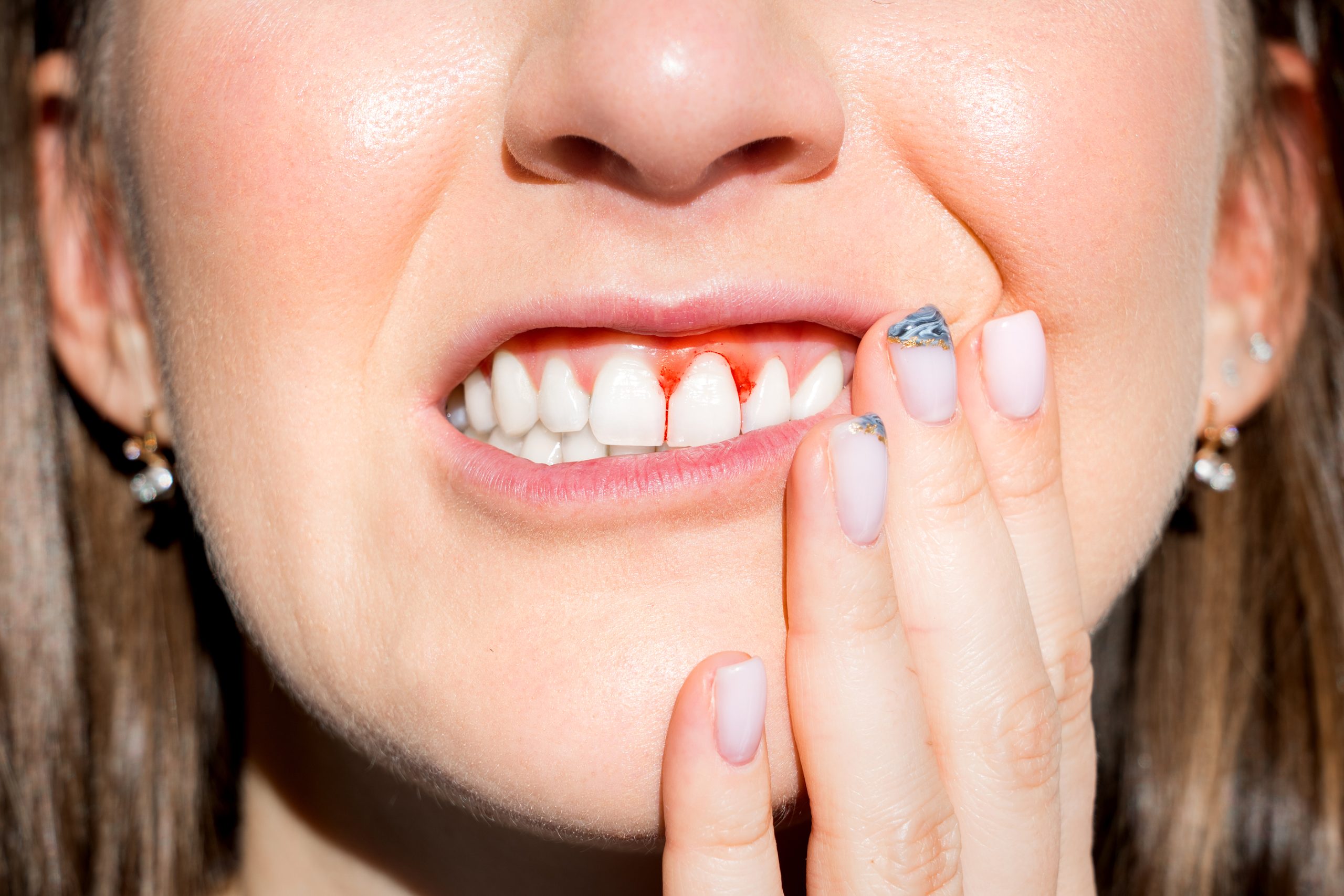 How Does Periodontal Disease Affect Other Health Issues?